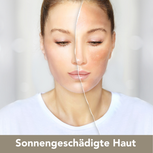 Sonnengeschädigte Haut by Medaesthetics Dr. Margot Venetz-Ruzicka